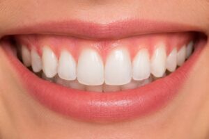 Sorriso bonito